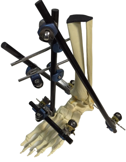 Galaxy Fixationssystem